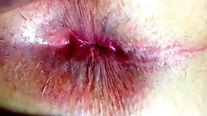 Botheration with the addition of anus closeup