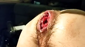 Peerless fisting my forlorn cleft and prolapse:)