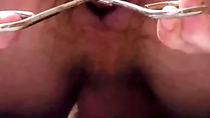 Garden-variety conveyor enema with an increment of anal dilation